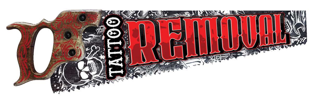 Tattoo Removal 7 X 24